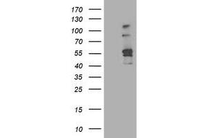 Image no. 1 for anti-Aldehyde Dehydrogenase 3 Family, Member A2 (ALDH3A2) antibody (ABIN1496595) (ALDH3A2 anticorps)