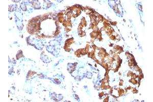 Formalin-fixed, paraffin-embedded Rat Pancreas stained with TNF alpha Mouse Monoclonal Antibody (TNFA/1172).