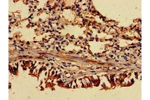 Immunohistochemistry of paraffin-embedded human lung tissue using ABIN7143158 at dilution of 1:100