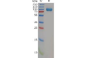 Human CD26 Protein, His Tag on SDS-PAGE under reducing condition.