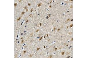 Immunohistochemistry of paraffin-embedded rat brain using LGALS3 antibody at dilution of 1:200 (x400 lens) (Galectin 3 anticorps  (AA 1-250))