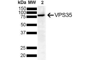 Western Blot analysis of Human SH-SY5Y showing detection of VPS35 protein using Mouse Anti-VPS35 Monoclonal Antibody, Clone 8A3 (ABIN6932974).