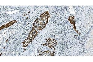 IHC analysis of Glycine decarboxylase/GLDC using anti-Glycine decarboxylase/GLDC antibody (ABIN7602073). (GLDC anticorps  (AA 574-1020))