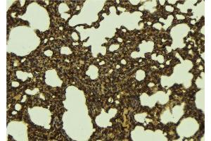 ABIN6276705 at 1/100 staining Mouse lung tissue by IHC-P. (RENT1/UPF1 anticorps)