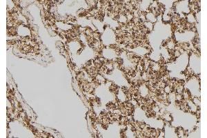 ABIN6275518 at 1/100 staining Rat lung tissue by IHC-P. (DVL2 anticorps  (C-Term))