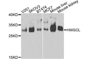 Western blot analysis of extracts of various cells, using HMGCL antibody. (HMGCL anticorps)