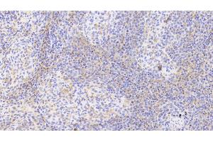 Detection of HbA1c in Human Spleen Tissue using Polyclonal Antibody to Glycated Hemoglobin A1c (HbA1c)