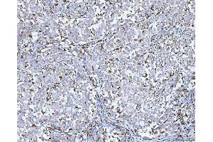 IHC analysis of CD14 using anti-CD14 antibody (ABIN3044565). (CD14 anticorps  (AA 65-327))