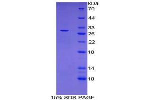 SDS-PAGE (SDS) image for CD302 (CD302) (AA 23-232) protein (His tag) (ABIN1879495) (DCL1 Protein (AA 23-232) (His tag))