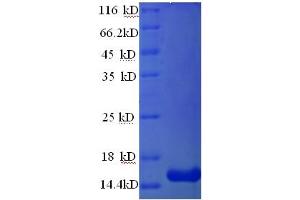 SDS-PAGE (SDS) image for Glucagon-Like Peptide 1 Receptor (GLP1R) (AA 24-145), (Extracellular) protein (His tag) (ABIN5709587)