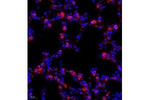 Immunofluorescence (IF) image for anti-Chloride Intracellular Channel 6 (CLIC6) antibody (ABIN7073478) (CLIC6 anticorps)