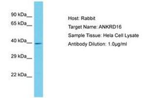 Image no. 1 for anti-Ankyrin Repeat Domain 16 (ANKRD16) (AA 43-92) antibody (ABIN6750615) (ANKRD16 anticorps  (AA 43-92))