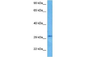 Host:  Rabbit  Target Name:  CBR3  Sample Tissue:  Human U937 Whole Cell lysates  Antibody Dilution:  1ug/ml (CBR3 anticorps  (C-Term))