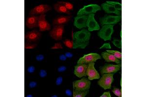 ABIN7094246 and ABIN7098293 staining Hela cells by IF/ICC. (GABPB1 anticorps  (Internal Region))