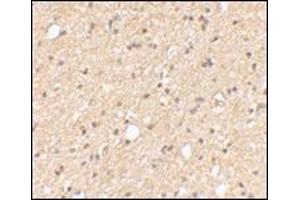 Immunohistochemical staining of human brain tissue using AP30499PU-N at 2. (LGI2 anticorps  (Center))