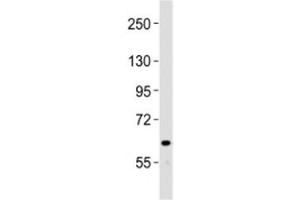 Western blot testing of NOTCH4 antibody at 1:2000 dilution + human liver lysate