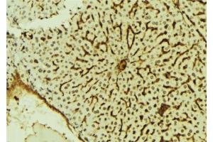 ABIN6279807 at 1/100 staining Mouse liver tissue by IHC-P. (SCML2 anticorps  (Internal Region))