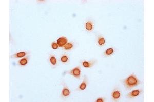 Immunocytochemistry analysis of ABIN7139170 diluted at 1:15 and staining in Hela cells (treated with 30mM sodium butyrate for 4h) performed on a Leica BondTM system.