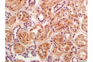 Formalin-fixed and paraffin embedded human kidney labeled with Anti-BBS5 Polyclonal Antibody, Unconjugated (ABIN1386114) at 1:200 followed by conjugation to the secondary antibody and DAB staining
