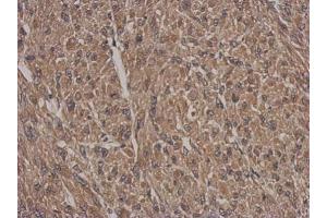 IHC-P Image Immunohistochemical analysis of paraffin-embedded U87 xenograft, using HSF2BP, antibody at 1:500 dilution.