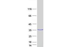 Validation with Western Blot