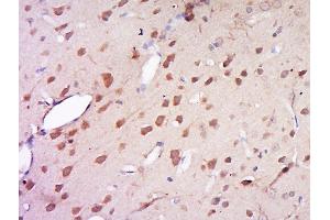 Paraformaldehyde-fixed, paraffin embedded rat brain, Antigen retrieval by boiling in sodium citrate buffer (pH6) for 15min, Block endogenous peroxidase by 3% hydrogen peroxide for 30 minutes, Blocking buffer (normal goat serum) at 37°C for 20min, Antibody incubation with Rabbit Anti-AMN1 Polyclonal Antibody, Unconjugated  at 1:500 overnight at 4°C, followed by a conjugated secondary for 90 minutes and DAB staining.