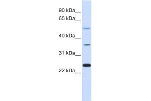 WB Suggested Anti-ZNF488 Antibody Titration:  0. (ZNF488 anticorps  (Middle Region))