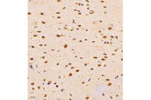 Immunohistochemistry of paraffin embedded mouse brain using ALS2CR13 (ABIN7073909) at dilution of 1:1800 (400x lens) (FAM117B anticorps)