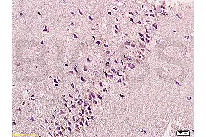 Formalin-fixed and paraffin embedded: rat brain tissue labeled with Anti-bFGF Polyclonal Antibody, Unconjugated (ABIN726425) at 1:200, followed by conjugation to the secondary antibody and DAB staining