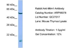 Western Blotting (WB) image for anti-Myotubularin 1 (MTM1) (N-Term) antibody (ABIN2786502) (MTM1 anticorps  (N-Term))