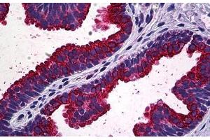 Human Prostate: Formalin-Fixed, Paraffin-Embedded (FFPE) (MAPK13 anticorps  (AA 251-365))