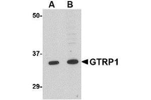 Western blot analysis of GRTP1 in K562 cell lysate with AP30387PU-N GRTP1 antibody at (A) 1 and (B) 2 μg/ml. (GRTP1 anticorps  (N-Term))