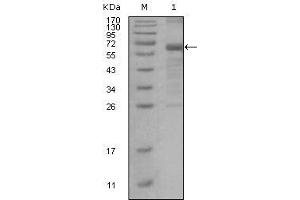 Western blot analysis using MSH6 mouse mAb against truncated MSH6 recombinant protein. (MSH6 anticorps)