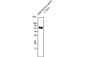 Western Blotting (WB) image for anti-SARS-CoV-2 Nucleocapsid (SARS-CoV-2 N) (C-Term) antibody (ABIN7272991) (SARS-CoV-2 Nucleocapsid anticorps  (C-Term))