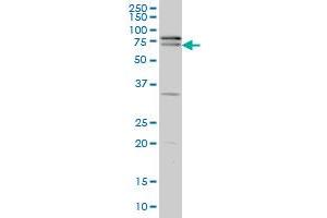 ZNF181 monoclonal antibody (M01), clone 5F1 Western Blot analysis of ZNF181 expression in A-431 .