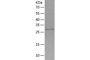 Western Blotting (WB) image for Coiled-Coil Domain Containing 101 (CCDC101) (AA 1-293) protein (His-IF2DI Tag) (ABIN7122425)