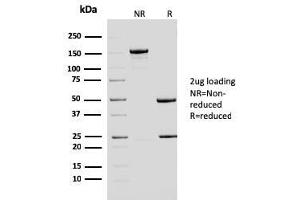 SDS-PAGE Analysis Purified ERCC1 Mouse Monoclonal Antibody (ERCC1/2683). (ERCC1 anticorps  (AA 191-281))