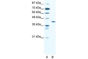 ZNF621 antibody (20R-1078) used at 0. (ZNF621 anticorps  (Middle Region))