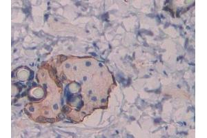 DAB staining on IHC-P; Samples: Rat Skin Tissue
