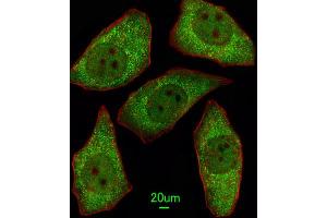 anti-Methionine Sulfoxide Reductase A (MSRA) antibody