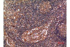 Immunohistochemistry (IHC) analysis of paraffin-embedded Human Lymph Gland, antibody was diluted at 1:100.