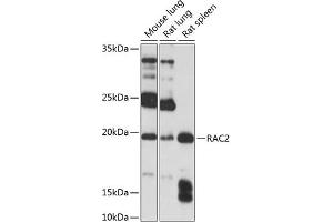 Western blot analysis of extracts of various cell lines, using R Polyclonal Antibody (ABIN3021523, ABIN3021524, ABIN3021525 and ABIN6215193) at 1:1000 dilution. (RAC2 anticorps  (AA 1-192))