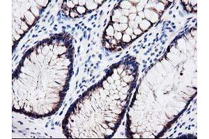 Immunohistochemical staining of paraffin-embedded Human colon tissue using anti-LXN mouse monoclonal antibody. (Latexin anticorps)