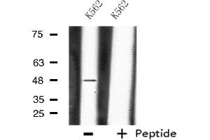 Western blot analysis of extracts from K562 cells, using CHST1 antibody. (CHST1 anticorps  (Internal Region))