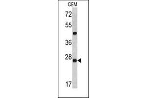 Image no. 1 for anti-Dicer 1, Ribonuclease Type III (DICER1) (AA 1010-1040), (Middle Region) antibody (ABIN357311) (DICER1 anticorps  (Middle Region))