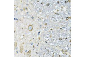 Immunohistochemistry of paraffin-embedded mouse spinal cord using DARS antibody.