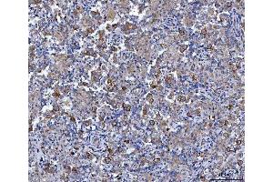 IHC analysis of CCNB1 using anti-CCNB1 antibody (ABIN7599335). (Cyclin B1 anticorps  (AA 1-383))