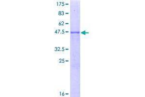 Image no. 1 for RAB8B, Member RAS Oncogene Family (RAB8B) (AA 1-207) protein (GST tag) (ABIN1317205)