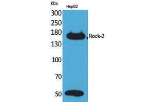 Western Blotting (WB) image for anti-rho-Associated, Coiled-Coil Containing Protein Kinase 2 (ROCK2) (Internal Region) antibody (ABIN3187730)