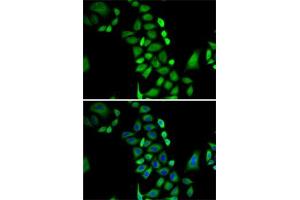 Immunofluorescence analysis of A-549 cells using GLO1 antibody (ABIN3015726, ABIN3015727, ABIN3015728 and ABIN6219077). (GLO1 anticorps  (AA 1-184))